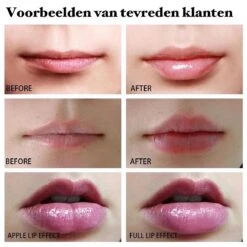 BenjaBeauty Lip Plumper - Lippen - Lipstick - Lippenbalsem - Rood - Wit -Mode Cosmetica Lipmake-Upwinkel 1200x1200 870