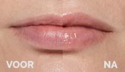 Instant Effects - 3D Lip Plumper Lipgloss Lip Filler - 20% Vollere Lippen In Slechts 2 Minuten! -Mode Cosmetica Lipmake-Upwinkel 1200x696