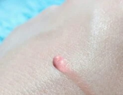 Biodermal Sun Lipbalm SPF25 - Tube 12 Ml - Natural Pink - Lippenbalsem -Mode Cosmetica Lipmake-Upwinkel 1200x927 3